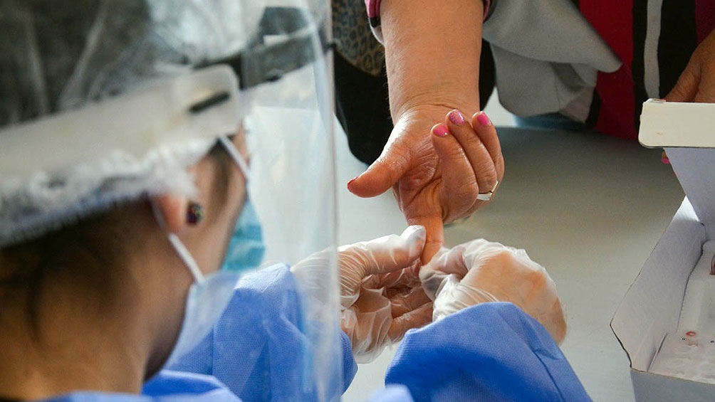 La Universidad de La Plata desarrolla un test rápido de detección de coronavirus La Universidad de La Plata desarrolla un test rápido de detección de coronavirus